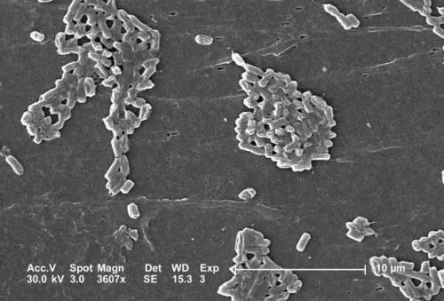 Quels types de bactéries se développent dans des environnements qui manquent Oxygen Free?