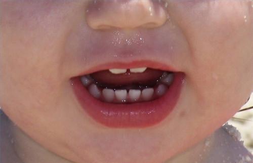 Bébé Croissance des dents