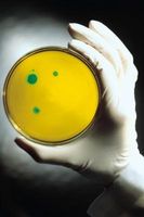 Similitudes entre bactéries et protistes