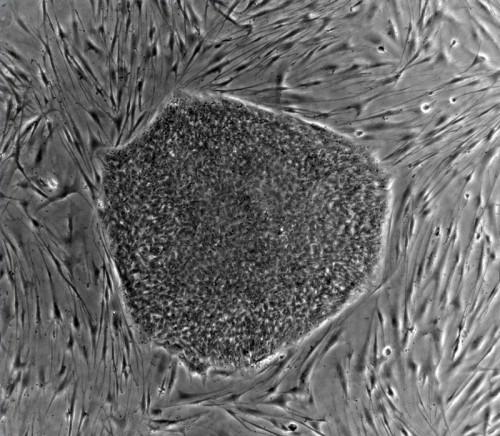 Où Ne proviennent les cellules souches pour la recherche sur les cellules souches?