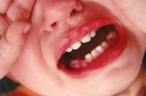 Comment savoir quand se brosser les dents d'un bébé